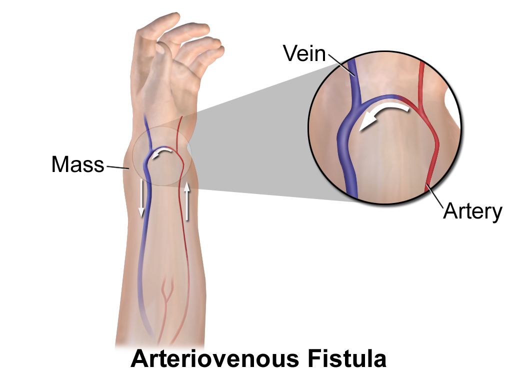 Image featuring Dr. Sadhana V. Kendre, specialist in AV Fistula Surgery at Shree Samarth Piles And Pain Clinic in Latur.